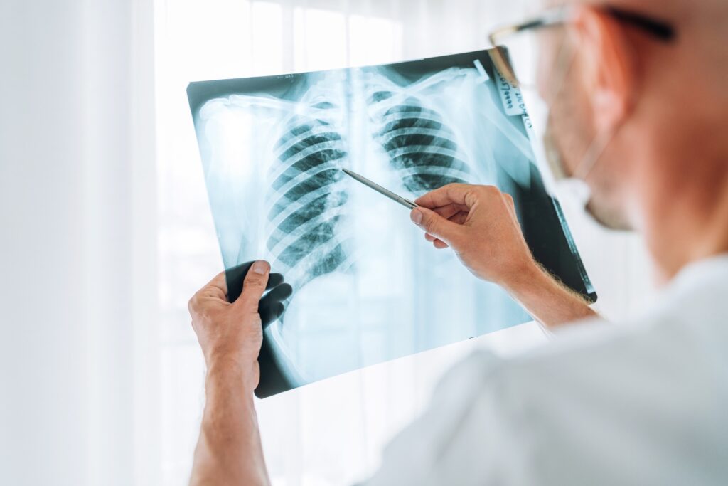 radiografie a domicilio Milano Monza-Brianza e comuni limitrofi