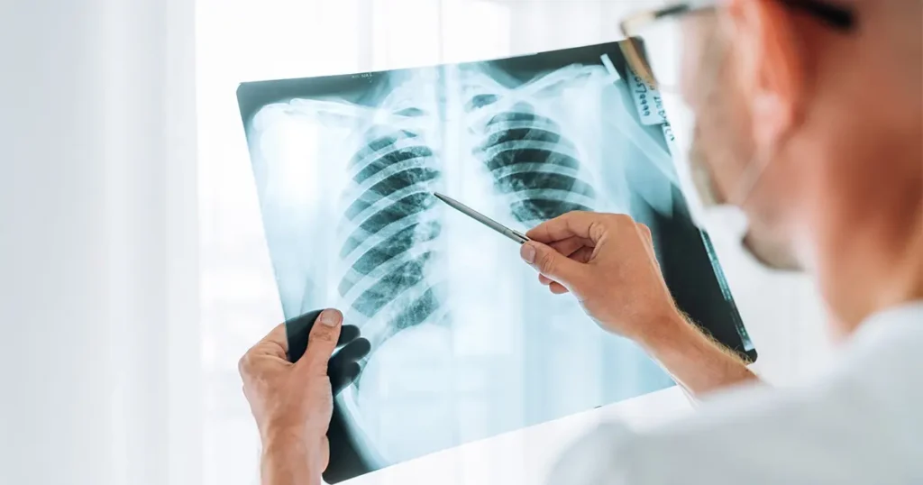 Radiografia a domicilio in Lombardia: un medico radiologo analizza un'immagine RX del torace per fornire una diagnosi professionale direttamente al domicilio del paziente.